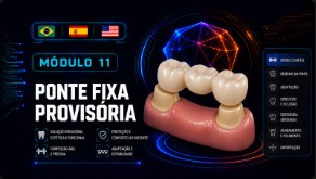 Ponte Fixa Provisória